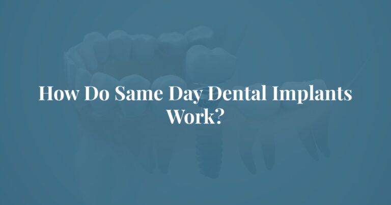 How Do Same Day Dental Implants Work? at Tyler Longview Oral Facial Surgery